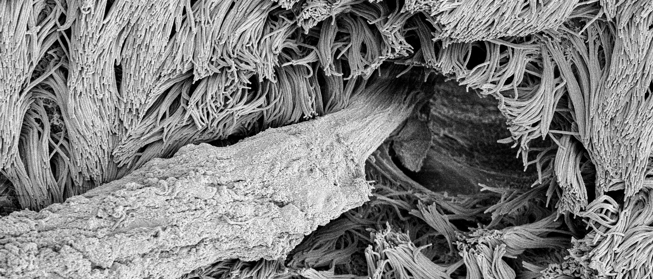 mucus-secretion