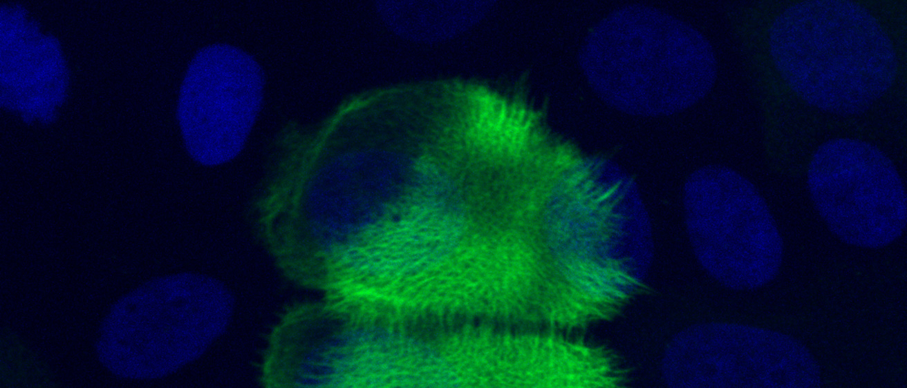 Microscopy