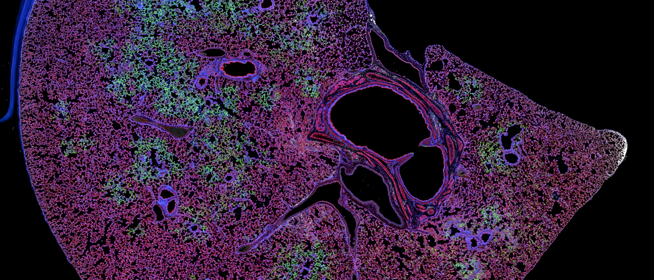 Confocal Snapshot