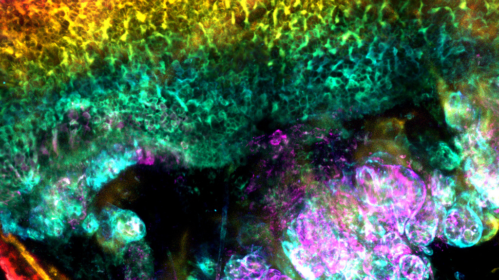 Rainbow Tracheal